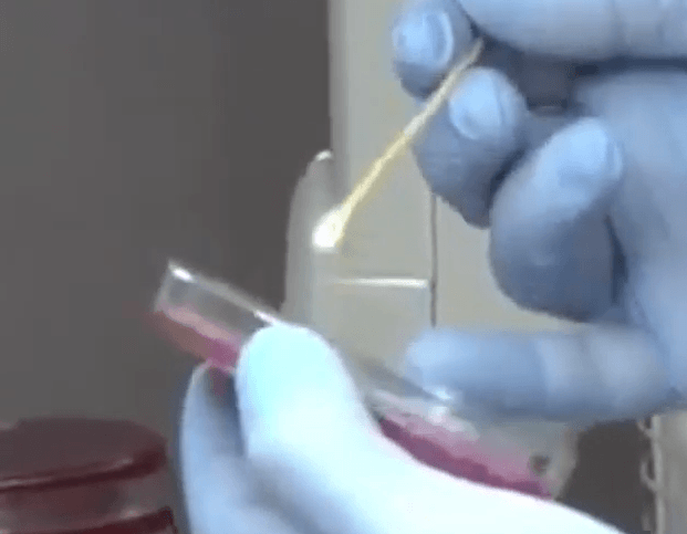 Piastrina per la coltivazione batterica in laboratorio